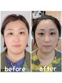 アコール 三軒茶屋(acoord)&nbsp;骨格補正スパ[カラー/ハイライト/ヘッドスパ/髪質改善/三軒茶屋]