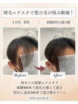 エクステサロンエム(EXTE SALON M)&nbsp;メンズも増毛エクステの前髪エクステでバレずに増毛！