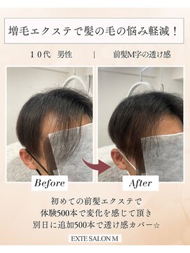 エクステサロンエム(EXTE SALON M) メンズも増毛エクステの前髪エクステでバレずに増毛!