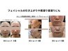 【一宮初導入!】お顔のスピードリフトアップ無料相談クーポン