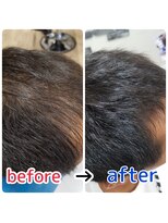 ブルーフィン シセロ(Blue Fin cicero) 頭皮改善!育毛促進ケア