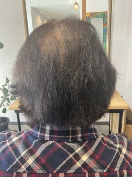 ファラヘアー(fara hair) 髪質の問題ではない