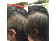 美髪研究所(BIHATSU)の雰囲気（細毛のお悩みは一度ご相談ください。一緒に課題を解決しましょう）