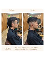 グランバイ アトリエドングリ(Grand × AtlierDonguri)&nbsp;お客様髪質改善データ2022（ツーブロックのライン）