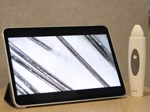 ☆頭皮カメラでチェック＆カウンセリング☆