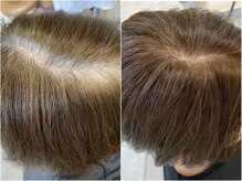 白髪と調和するカラーに★【明るい白髪染め】×【透明感】［ヘッドスパ/髪質改善/オージュア/センター北］