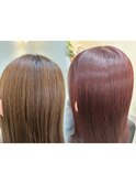 矯正before after