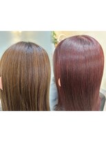 タイニー(Tiny)&nbsp;矯正before after