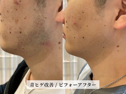 カミケンオム(kamiken. homme)の写真