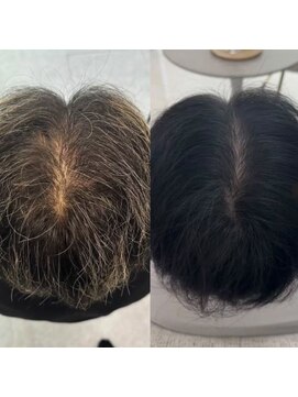 プラスケー(+k) プロセルセラピーズスタイル