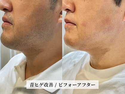 カミケンオム(kamiken. homme)の写真