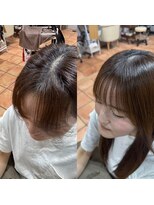 ボクノ つくば桜店(bokuno)&nbsp;顔まわり　生えぐせ　矯正