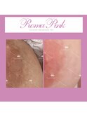 ローマピンク【乳輪】