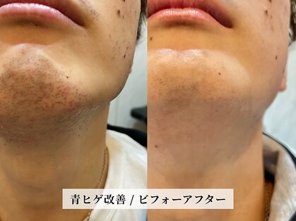 カミケンオム(kamiken. homme)の写真