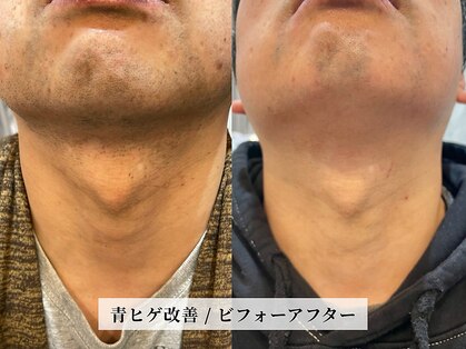 カミケンオム(kamiken. homme)の写真