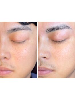 眉毛のお手入れはプロにお任せ！眉毛を整えるのが苦手な方に◎爽やかさと清潔感あるデザインをお届け♪