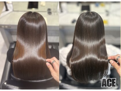 エース(ACE:Re)の写真