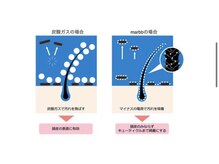 髪・頭皮の【小さな隙間まで入り込む】特殊な技術！