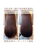 20代女性【髪の美容整形施術】