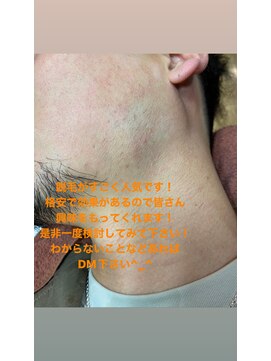 サンバス もりの里店(Sunbath) 脱毛