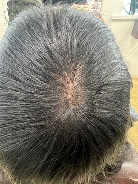 アローズ(arose) 大人エクステビフォーアフター