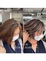 レディアル 大宮(REDEAL ope.)&nbsp;【ハイライト】ハイライトバレイヤージュ