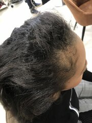 【AnFye.dueldo】生え際のくせ毛もしっかり艶髪ストレートヘア