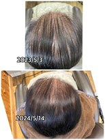 エミ(EMI)&nbsp;育毛促進