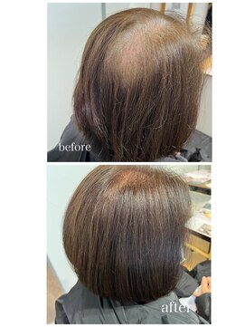 アクロ ヘアー(ACRO HAIR) ふんわり地肌ケアお白髪染めで未来の為に！