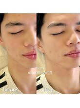 トリコ(trico) メンズナチュラルブロウリフト