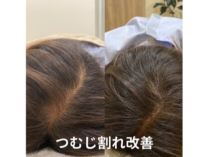 ハリトカミの写真