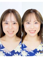アガール&nbsp;黄金比メイク&フォトプラン