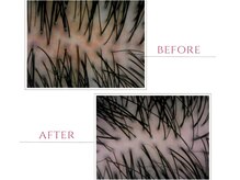 アリーザ オオサカ(aleeza Osaka)の雰囲気（お客様にご好評の、頭皮のbefore/afterチェック◎）