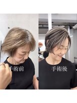 レディアル 大宮(REDEAL ope.)&nbsp;【ハイライト】ハイライトバレイヤージュ