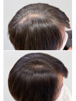 エーティーヘアコレクション 自由が丘(AT.hair collection)&nbsp;ノンジアミン