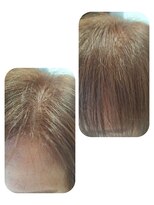 ユーフォルムギンザ(y-Forme Ginza)&nbsp;話題のトキカタ♪前髪編