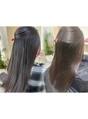 矯正before after