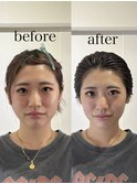 骨格補正スパ・バランス小顔矯正