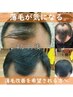 脱毛・抜け毛【改善】　髪育ヘッドスパコース ※カット別