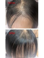 コティ(Kotii)&nbsp;【特許技術】エンジェリックケアで生え癖のお悩み解決します！