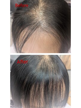 コティ(Kotii) 【特許技術】エンジェリックケアで生え癖のお悩み解決します!