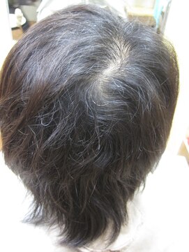 ヨシユキコンディショニング エイジレス　特許「つむじ補正」　つむじ、分け目が目立つ方３９