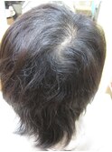 エイジレス 特許「つむじ補正」 つむじ、分け目が目立つ方39
