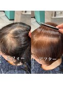 明るくする白髪染め　リムーバーカラー