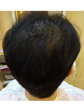 ラピスるり ボリュームエクステ