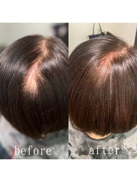 ツムグ 代官山店(TUMUGU) 【地肌見え】おとな女性悩み解消ボリュームアップエクステ代官山