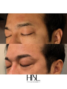 スターダスト(STAR DUST.) 新HBL