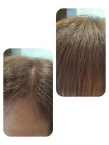 ユーフォルムギンザ(y-Forme Ginza)&nbsp;話題のトキカタ♪前髪編