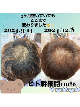 ヒト幹細胞110パーセント