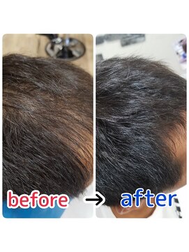 ブルーフィン シセロ(Blue Fin cicero) 頭皮改善！育毛促進ケア